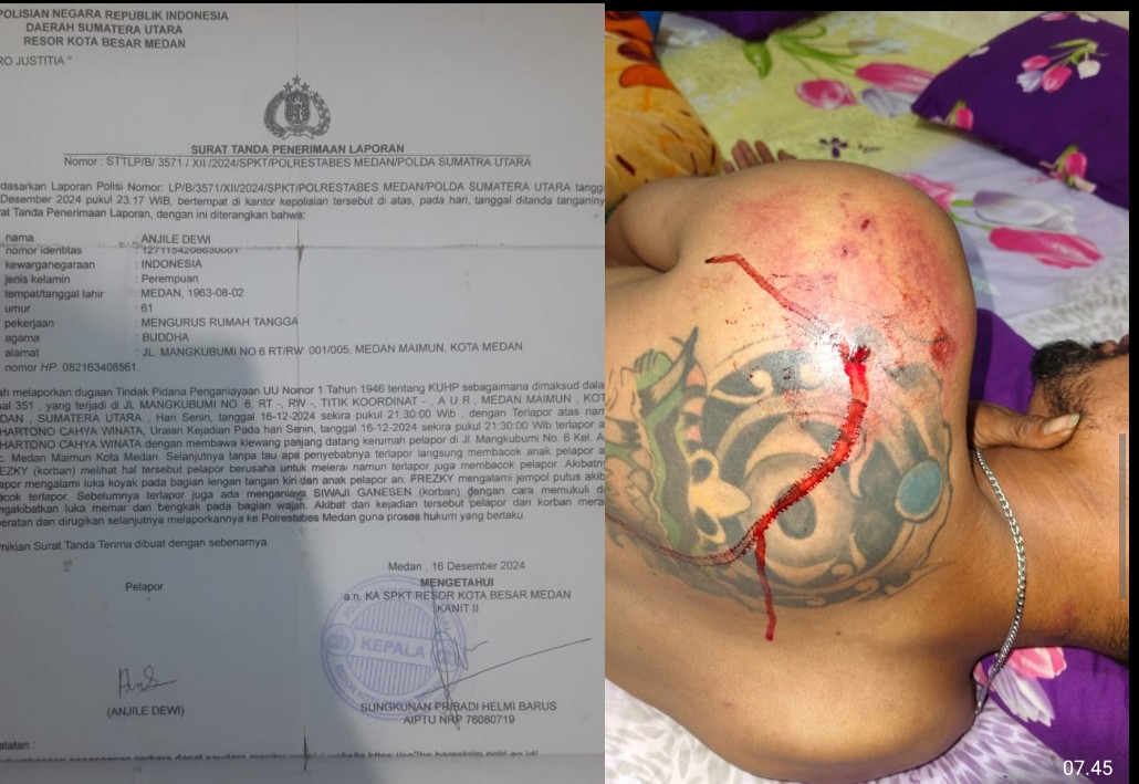 Brutal! Warga Mangkubumi Dikeroyok, Gigi Patah hingga Punggung Ditikam