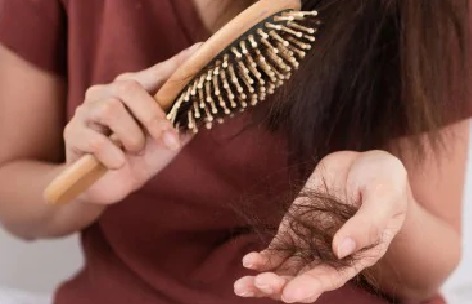 Kerontokan Dapat Diatasi dengan Ini