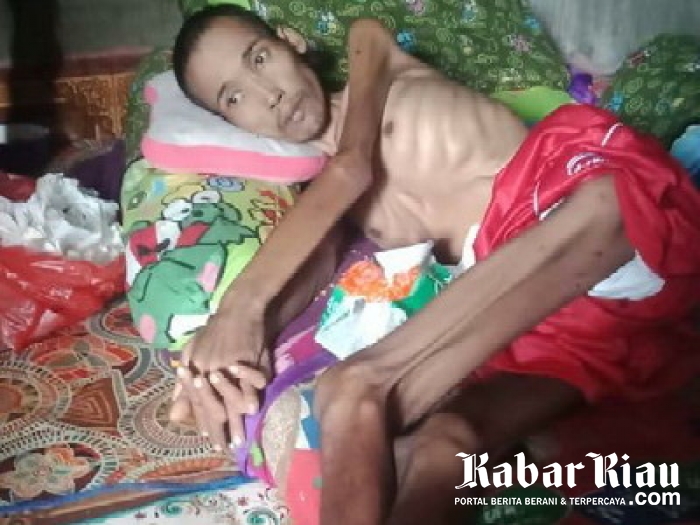 Terbaring Kurus Delapan Bulan, DR Huda Minta Doa Kesembuhan Warga Rohil Ini