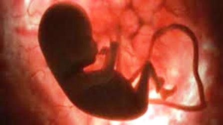 Tragis, Pasien Aborsi di Klinik Sejahtera Pandeglang Janin Dibuang ke Lobang WC