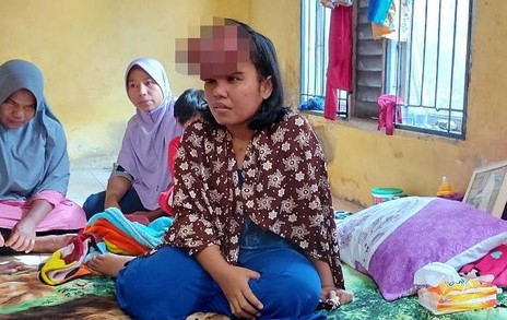 Gubri Minta Diskes Rujuk Pasien Tumor Warga Pekanbaru ke RS Hasan Sadikin, Bandung