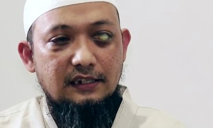 Komnas HAM Ingatkan Kapolri Baru Lanjutkan Usut Kasus Novel