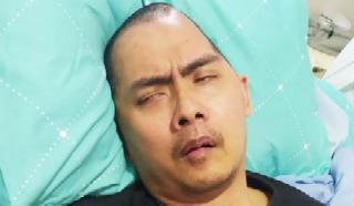 Mantan Kasat Reskrim Polres Wonogiri Korban Pengeroyokan Butuh Bantuan Polri