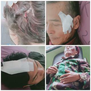 Masyarakat Natumingka Dianiaya, AMAN: Usut PT TPL