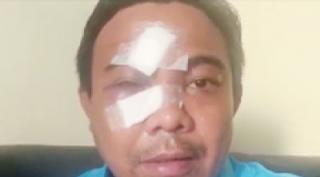 Alhamdulillah Hitungan Hari Pengeroyok Haris Pratama Dibekuk, “Polisi Mulai Dari CCTV”