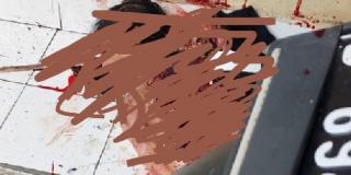 Tubuh Terduga Pelaku Ledakan di Polsek Astana Anyar Bolong, Polisi Juga Luka-luka