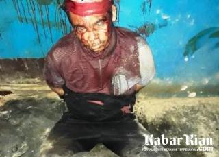 Tragis, Petani Ubi di Duri Dianiya Security Perusahaan HTI Hingga Babak Belur