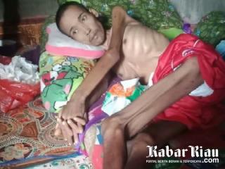 Terbaring Kurus Delapan Bulan, DR Huda Minta Doa Kesembuhan Warga Rohil Ini