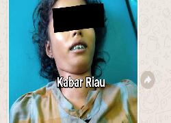 ABG Bengkalis Tewas dalam Kamar Hotel Wisata, Dugaan Sementara Over Dosis