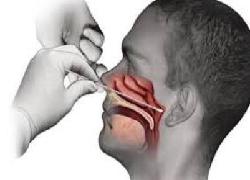 Terkait Positif Corona, Asril: Tak Ada Rilis Gugus Tugas Sebut Nama