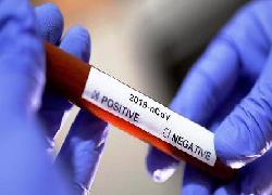 Dari 200 Pedagang di Pasar Cimahi di Rapid Tes, 2 Positift