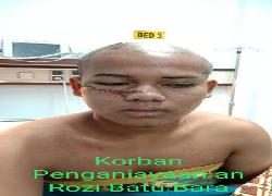 Gara-Gara Batal Kesepakatan! Pipi Dan Kepala Belakang Warga Tanjung Medan Dibacok Anak Pemilik Excavator
